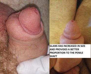 benu pandit share penis with big head photos