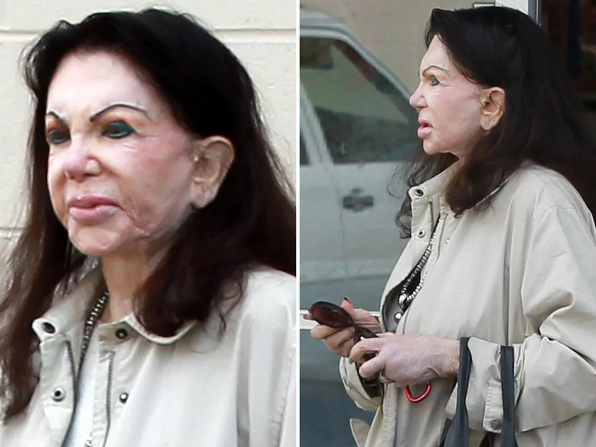 zazie skymm facial