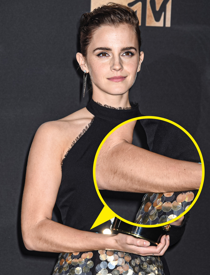 benildus fernando share hairy emma watson photos