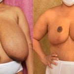 christine gaisford recommends Huge Saggy Titts